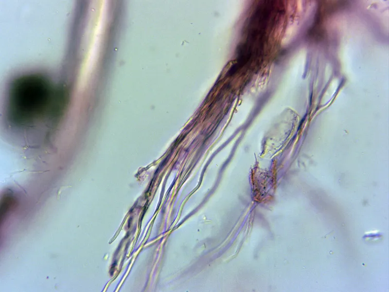 Auricularia mesenterica 16 - Pelos cutícula x 400